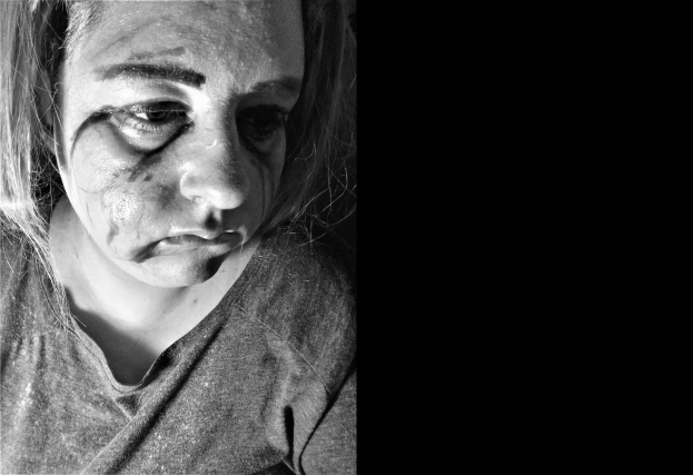 Schwarz-weißes Foto einer Frau mit Gesichtsverletzungen, ernstem Gesichtsausdruck, konzentriertem Blick, zurückgebundenem Haar und einem T-Shirt.